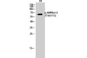 Western Blotting (WB) image for anti-AMPK1/AMPK2 (pThr172), (pThr183) antibody (ABIN3173192) (PRKAA1/PRKAA2 Antikörper  (pThr172, pThr183))