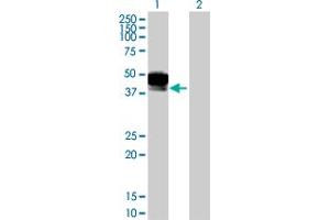 Western Blot analysis of DCN expression in transfected 293T cell line by DCN MaxPab polyclonal antibody. (Decorin Antikörper  (AA 1-359))