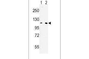 Western blot analysis of MTTP Antibody (C-term) (ABIN653011 and ABIN2842637) in Hela(lane 1), 293(lane 2) cell line lysates (35 μg/lane). (MTTP Antikörper  (C-Term))