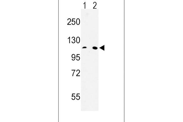 MTTP Antikörper  (C-Term)