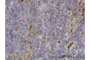 Immunoperoxidase of monoclonal antibody to FGR on formalin-fixed paraffin-embedded human lymph node. (Fgr Antikörper  (AA 1-90))
