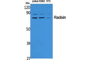 Western Blot (WB) analysis of specific cells using Radixin Polyclonal Antibody. (Radixin Antikörper  (Internal Region))