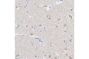 Immunohistochemical staining of human lateral ventricle with ASPHD2 polyclonal antibody  shows cytoplasmic positivity in neuronal cells. (ASPHD2 Antikörper)