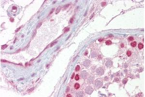 Immunohistochemistry (IHC) image for anti-Wingless-Type MMTV Integration Site Family, Member 2B (WNT2B) (Middle Region) antibody (ABIN2776710)