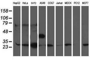 Image no. 2 for anti-phosphoglycerate Mutase 2 (Muscle) (PGAM2) antibody (ABIN1500170) (PGAM2 Antikörper)
