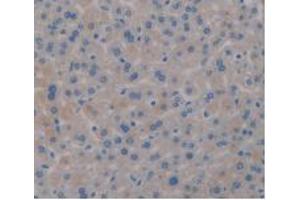 IHC-P analysis of Mouse Liver Tissue, with DAB staining.