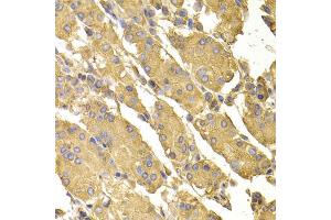 Immunohistochemistry of paraffin-embedded human stomach using PPP2CA antibody (ABIN5974047) at dilution of 1/100 (40x lens).
