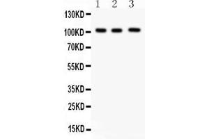 Anti- ITCH Picoband antibody, Western blottingAll lanes: Anti ITCH  at 0. (ITCH Antikörper  (Middle Region))