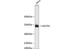 Western blot analysis of extracts of HeLa cells, using HE antibody  at 1:3000 dilution. (HEATR1 Antikörper  (AA 1-120))