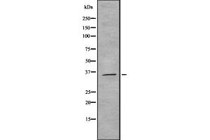 Western blot analysis of ROAA expression in HEK293 cells ,The lane on the left is treated with the antigen-specific peptide. (HNRNPAB Antikörper  (N-Term))
