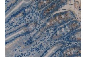 Detection of MMP9 in Rat Intestine Tissue using Polyclonal Antibody to Matrix Metalloproteinase 9 (MMP9) (MMP 9 Antikörper  (AA 226-391))