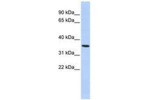 Image no. 1 for anti-Progestin and AdipoQ Receptor Family Member VI (PAQR6) (AA 72-121) antibody (ABIN6741069) (PAQR6 Antikörper  (AA 72-121))