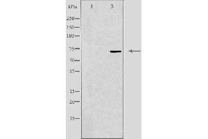 Western blot analysis of extracts from Jurkat cells, using FZD8 antibody.