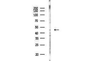 Western blot analysis of lysates from K562 cells(UV 30 min treatment), using ALX4 Antibody at 1/1000 dilution.