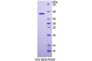 SDS-PAGE analysis of Rabbit Interferon alpha Protein. (IFNA Protein)