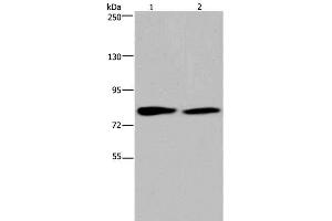 Western Blot analysis of K562 and 293T cell using TXLNA Polyclonal Antibody at dilution of 1:350 (alpha Taxilin Antikörper)