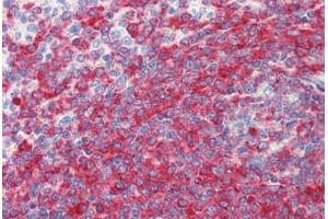 Human Spleen (formalin-fixed, paraffin-embedded) stained with PDCD4 antibody ABIN364343 at 5 ug/ml followed by biotinylated anti-mouse IgG secondary antibody ABIN481714, alkaline phosphatase-streptavidin and chromogen. (PDCD4 Antikörper  (AA 1-469))