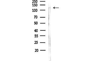anti-NUT (C-Term) antibody