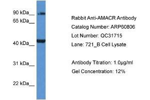 Western Blotting (WB) image for anti-alpha-Methylacyl-CoA Racemase (AMACR) (C-Term) antibody (ABIN2774297) (AMACR Antikörper  (C-Term))