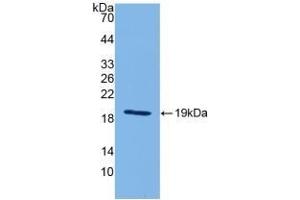 Detection of Recombinant IL18, Mouse using Polyclonal Antibody to Interleukin 18 (IL18) (IL-18 Antikörper  (AA 36-192))