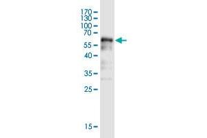 Western Blot detection against Immunogen (58. (BOD1L1 Antikörper  (AA 1-284))