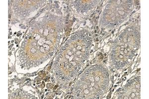 XRRA1 Mouse Monoclonal Antibody at 1/100 staining human normal colon tissue by IHC-P. (XRRA1 Antikörper)