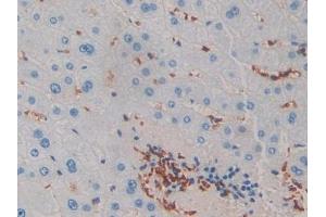 DAB staining on IHC-P; Samples: Human Liver Tissue (IL-2 Antikörper  (AA 21-153))