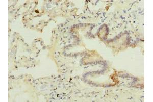 Immunohistochemistry of paraffin-embedded human lung tissue using ABIN7174888 at dilution of 1:100 (C7orf61 Antikörper  (AA 1-206))