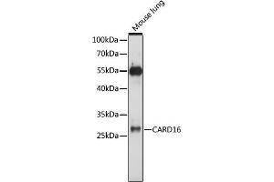 Western blot analysis of extracts of mouse lung, using C antibody (ABIN7266127) at 1:1000 dilution. (CARD16 Antikörper  (AA 50-150))