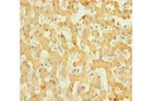 Immunohistochemistry of paraffin-embedded human liver tissue using ABIN7165010 at dilution of 1:100 (ABHD14B Antikörper  (AA 2-210))