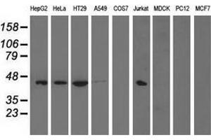 Western blot analysis of extracts (35 µg) from 9 different cell lines by using anti-PAICS monoclonal antibody. (PAICS Antikörper)