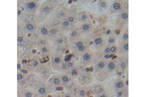 IHC-P analysis of Kidney tissue, with DAB staining. (Poliovirus Receptor Antikörper  (AA 22-255))