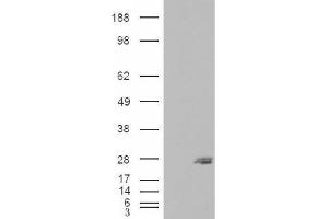 Image no. 1 for anti-SAR1 Homolog B (SAR1B) (Internal Region) antibody (ABIN375115) (SAR1B Antikörper  (Internal Region))