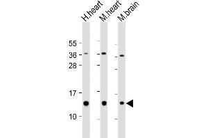All lanes : Anti-NDUFB3 Antibody (Center) at 1:2000 dilution Lane 1: human heart lysate Lane 2: mouse heart lysate Lane 3: mouse brain lysate Lysates/proteins at 20 μg per lane. (NDUFB3 Antikörper  (AA 14-49))