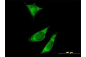 Immunofluorescence of purified MaxPab antibody to RPTOR on HeLa cell. (Raptor Antikörper  (AA 1-379))