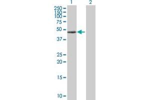 Western Blot analysis of PRKAR1A expression in transfected 293T cell line by PRKAR1A MaxPab polyclonal antibody. (PRKAR1A Antikörper  (AA 1-381))