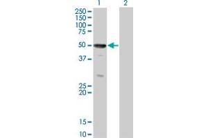 Western Blot analysis of SOCS4 expression in transfected 293T cell line by SOCS4 monoclonal antibody (M01), clone 2G8.