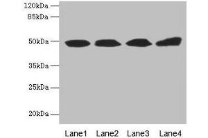 Western blot All lanes: TBCEL antibody at 12 μg/mL Lane 1: Rat gonadal tissue Lane 2: PC-3 whole cell lysate Lane 3: Rat heart tissue Lane 4: 293T whole cell lysate Secondary Goat polyclonal to rabbit IgG at 1/10000 dilution Predicted band size: 49 kDa Observed band size: 49 kDa (TBCEL Antikörper  (AA 1-424))