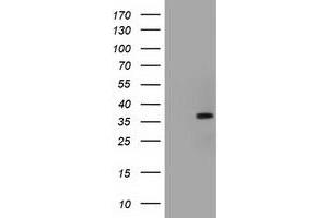 HEK293T cells were transfected with the pCMV6-ENTRY control (Left lane) or pCMV6-ENTRY ACAT2 (Right lane) cDNA for 48 hrs and lysed. (ACAT2 Antikörper)