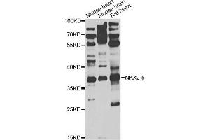 Western blot analysis of extracts of various cell lines, using NKX2-5 antibody (ABIN1876852) at 1:1000 dilution.