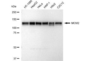 Western blotting analysis using MCM2 antibody (ABIN7799414).