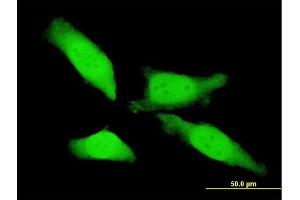 Immunofluorescence of monoclonal antibody to MTL5 on HeLa cell. (MTL5 Antikörper  (AA 399-508))