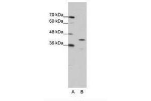 Image no. 1 for anti-Cytoplasmic Polyadenylation Element Binding Protein 2 (CPEB2) (AA 204-253) antibody (ABIN6736217) (CPEB2 Antikörper  (AA 204-253))