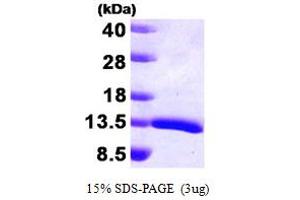 SDS-PAGE (SDS) image for Hepatoma-Derived Growth Factor (HDGF) (AA 1-100) protein (ABIN667748) (HDGF Protein (AA 1-100))