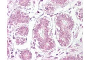 Anti-IKB Alpha antibody IHC of human breast. (NFKBIA Antikörper  (AA 34-48))