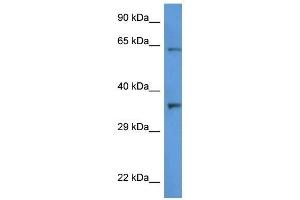 Western Blot showing CTSL2 antibody used at a concentration of 1 ug/ml against HT1080 Cell Lysate (Cathepsin L2 Antikörper  (C-Term))