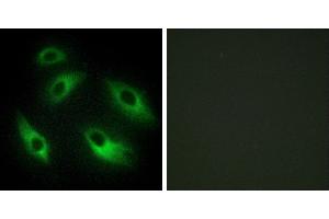 Peptide - +Immunofluorescence analysis of HeLa cells, using EPHB6 antibody. (EPH Receptor B6 Antikörper)
