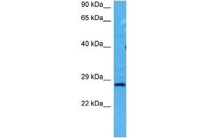 Host:  Mouse  Target Name:  HPRT1  Sample Tissue:  Mouse Testis  Antibody Dilution:  1ug/ml (HPRT1 Antikörper  (Middle Region))