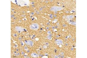 Immunohistochemistry analysis of paraffin-embedded mouse brain using,KCC2 (ABIN7075650) at dilution of 1: 1800 (KCC2 Antikörper)