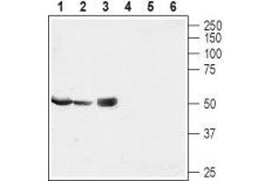 Western blot analysis of rat testis (lanes 1 and 4) and kidney lysates (lanes 2 and 5) and heart membrane (lanes 3 and 6): - 1-3. (MRS2 Antikörper  (Mitochondrial Matrix))